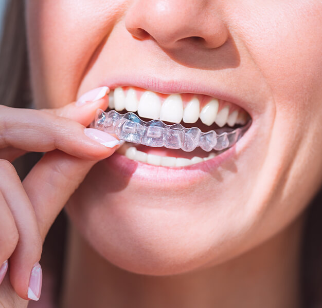 Ästhetische Zahnheikunde